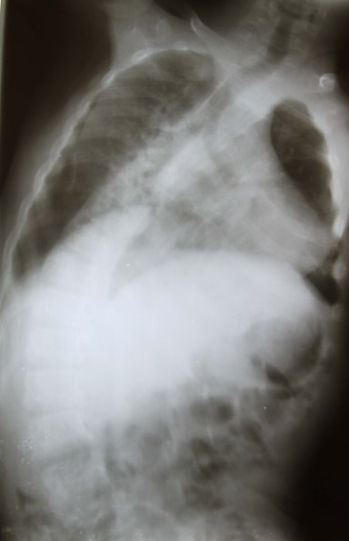 Image 1 Sheila's x-ray